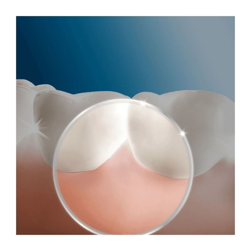 Dépôt Marron Sur Les Dents Au Reveil